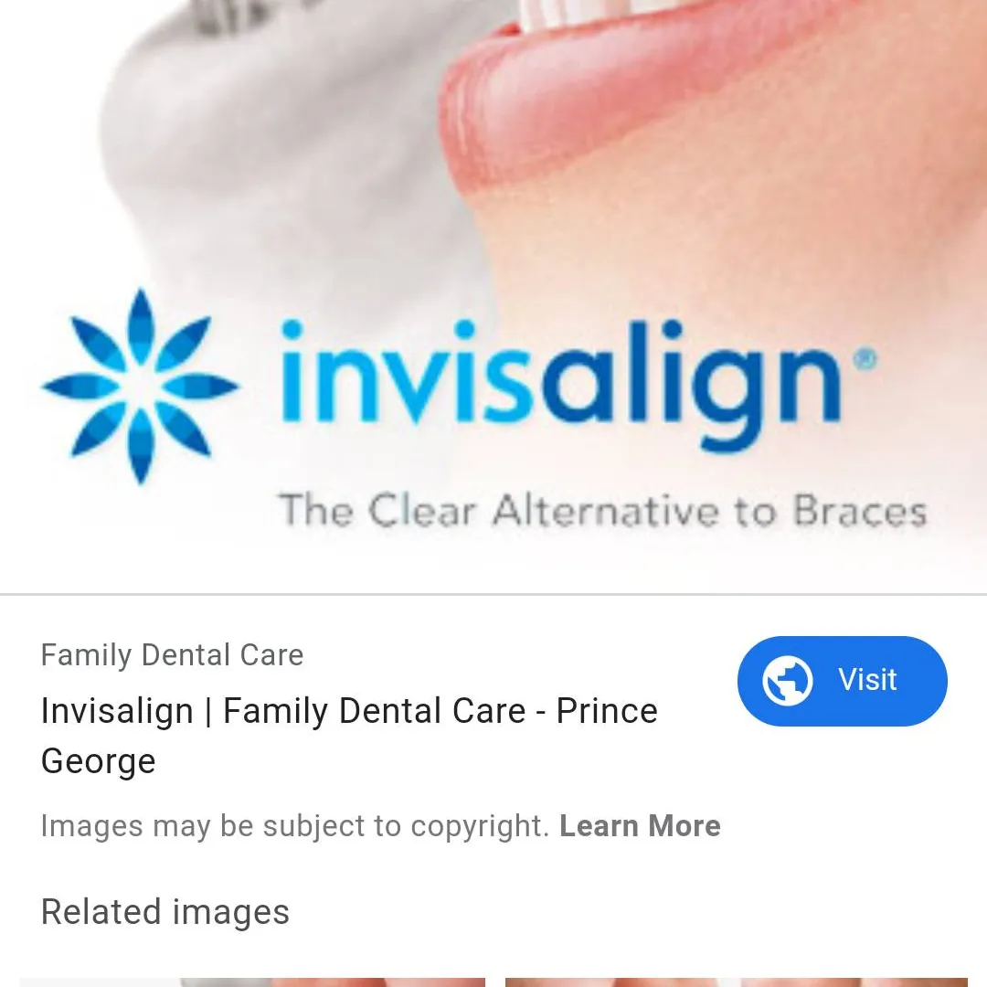 Invisalign Complete Treatment And Retainers photo 1