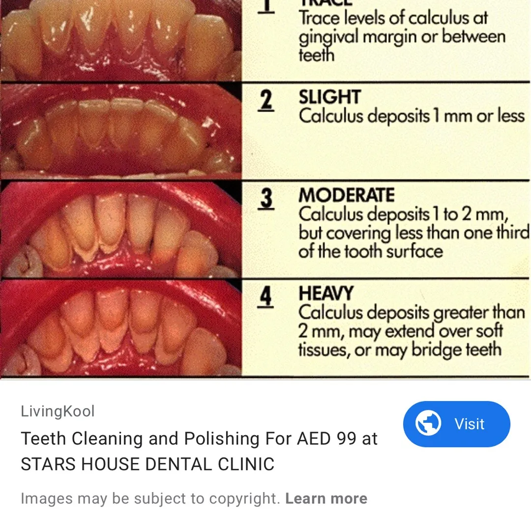 Free Teeth Cleaning photo 1